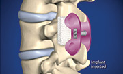 Surgical Options Spine Center Network center and neurosurgery center