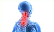 neck pain