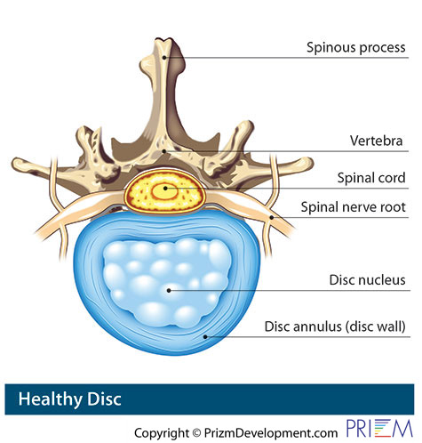 healthy disc